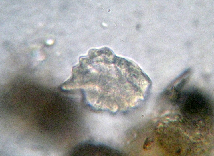 Protozoi del muschio: Phacodinium metchnicoffi ?